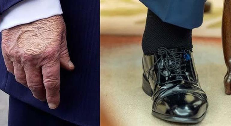6879e632d13a6e6d2d96bff0 GÜNLERDİR KONUŞULUYORDU: ABD BAŞKANI TRUMP'IN GİZEMLİ HASTALIĞI ORTAYA ÇIKTI!