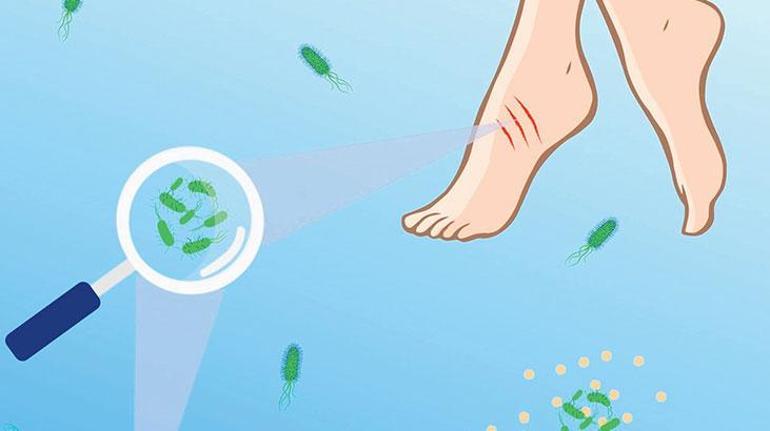 Vibrio alert on beaches: Do not swim with open wounds