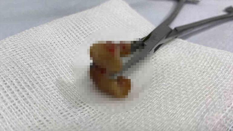 Uykuda diş kâbusu Aynada fark etti, ciğerinden çıktı: Çok sık görmeye başladık