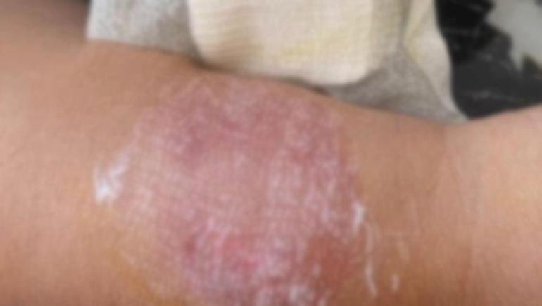 Büyükçekmece sahilinde sigara dumanı kavgası Kolunu ısırdı