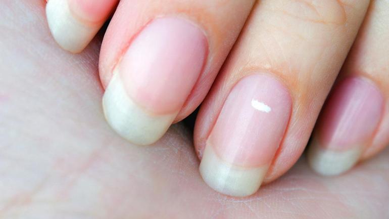 Tırnak sararmalarına birebir Hem güçlendiriyor hem de sağlıklı uzatıyor