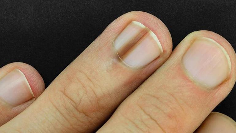 La cara oculta de las uñas de gel: Un nuevo escándalo en camino: ¿Belleza o daño genético?