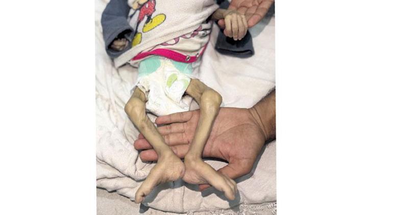 ‘Gazze insanlığın dip noktasıdır’