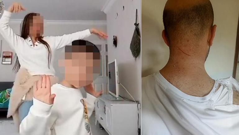 Ankara’da velayet kavgası Oğlunu TikTokta dans ettirdiğini iddia eden baba, eski eşi tarafından darp edildi