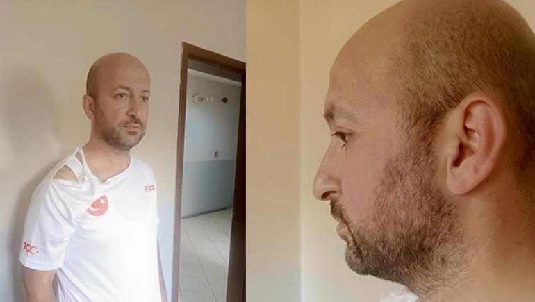 Ankara’da velayet kavgası Oğlunu TikTokta dans ettirdiğini iddia eden baba, eski eşi tarafından darp edildi