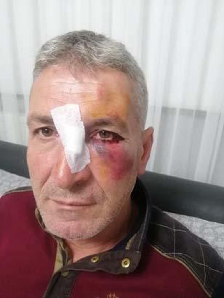 Kapısına hayvan dışkısı bırakıldı, kızgın yağ döküldü Komşu kabusunda ikinci perde