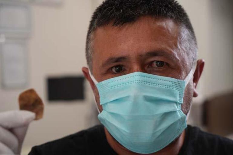 Burnundan yayılan koku nedeniyle herkes kaçıyordu Doktorları bile şaşkına çevirdi