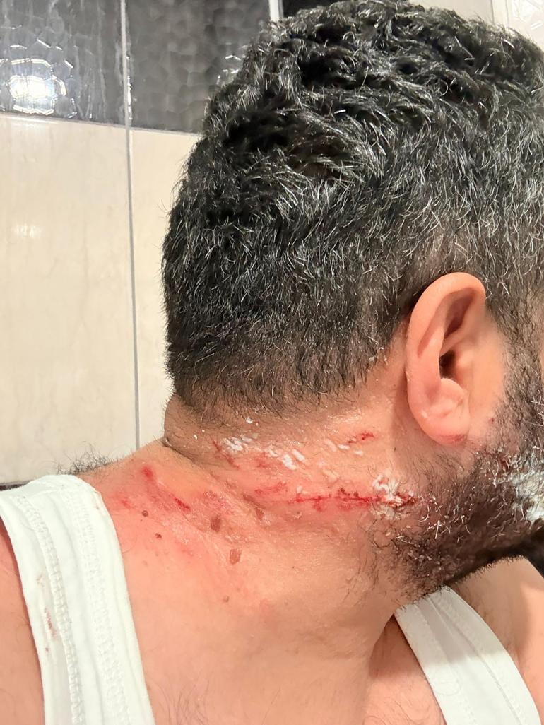 TIRın lastiği bomba gibi patladı Bu hale geldi