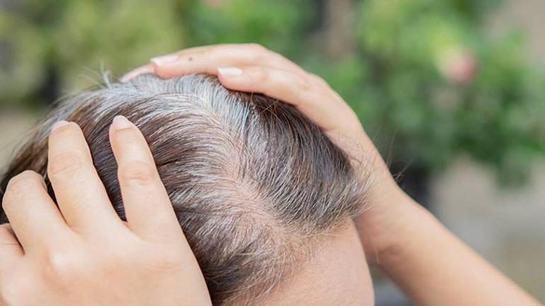 Beyaz saçların bilinmeyen sırrı Yaşlılık değilmiş: Hücreler kanserle mi savaşıyor