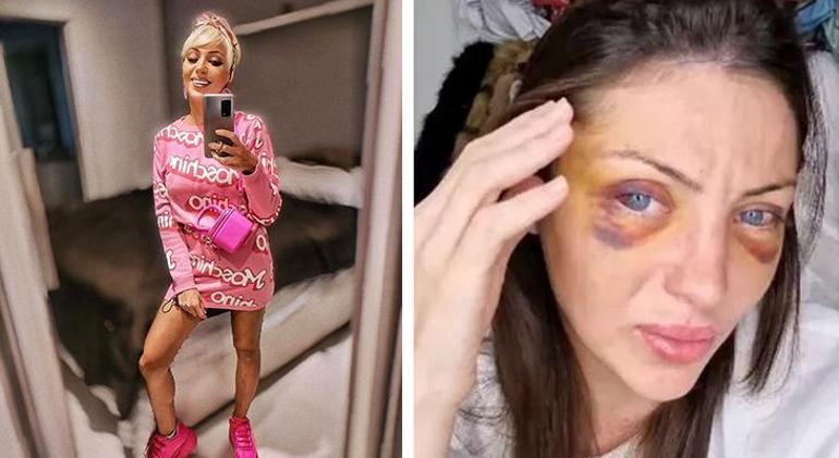 690c6eec3b681ccda513833e Barbie'ye benzemek uğruna 27 ameliyat geçirmişti! Sosyal medya fenomeninin gizemli ölümü