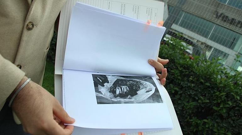 690efc4eb825a93f990105eb 18 milyonluk Porsche alev aldı! Canını zor kurtardı