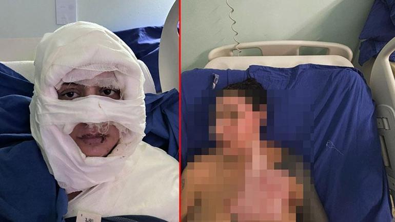 6911ad5936206bb89d50ad17 Kadıköy’de vahşet! Çakmakla yakılan kadına kan donduran mesajlar: 'Kız arkadaşım sizin yüzünüzden hapse girdi...'