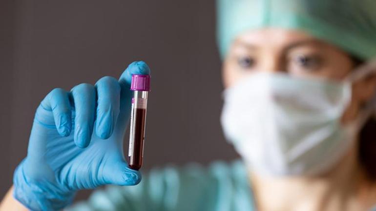 Dünyada sadece 50 kişide var Altın kan laboratuvarda üretilebilecek mi