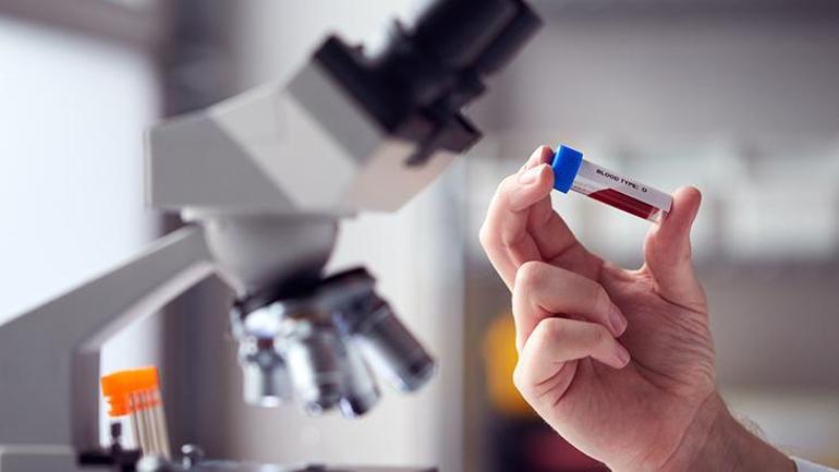 Dünyada sadece 50 kişide var Altın kan laboratuvarda üretilebilecek mi