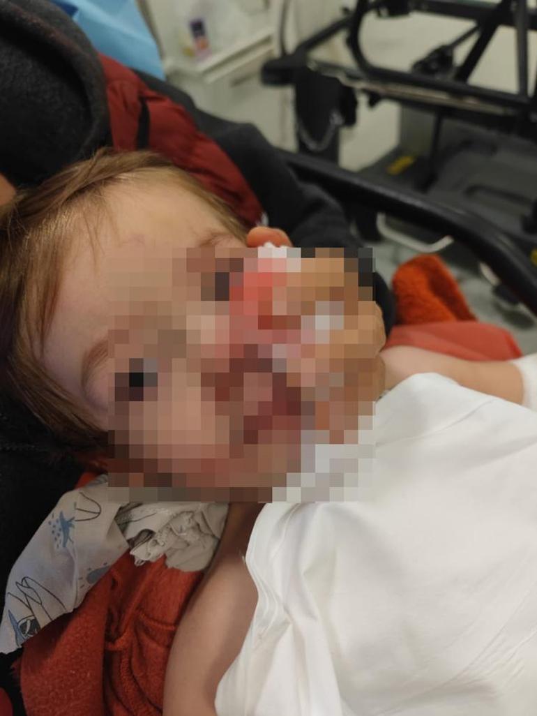 692c7af37417390292e31fec Başkentte pitbull dehşeti! 'Ceza almalarını istiyorum, yoksa çocuğumun yüzüne bakamam'