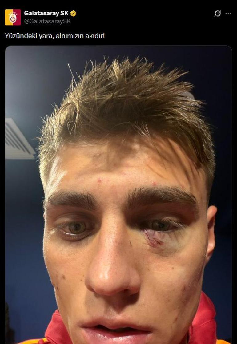 Galatasaraydan Kazımcan Karataş paylaşımı Alnımızın akıdır
