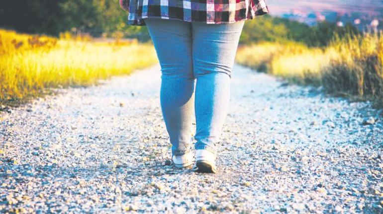 Çoğu zaman yanlış anlaşılan hastalık: Lipödem