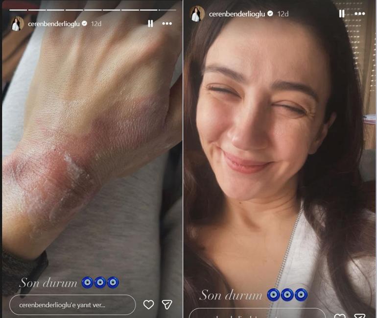 Eşref Rüya setinde talihsiz kaza Ceren Benderlioğlu neye uğradığını şaşırdı: Bu ne biçim nazar