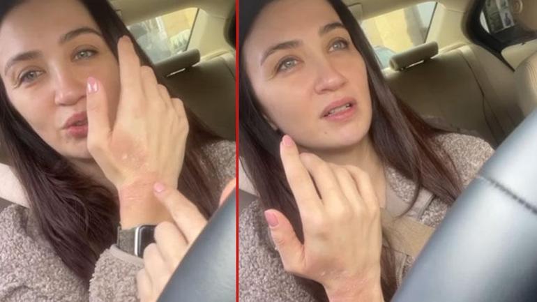 Eşref Rüya setinde talihsiz kaza Ceren Benderlioğlu neye uğradığını şaşırdı: Bu ne biçim nazar