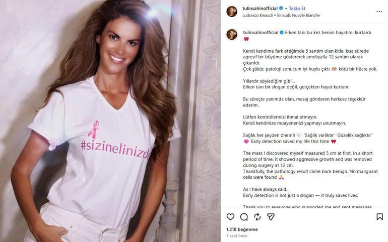 Göğsünden 12 santimlik tümör çıkarılmıştı Tülin Şahin’in patoloji sonuçları çıktı