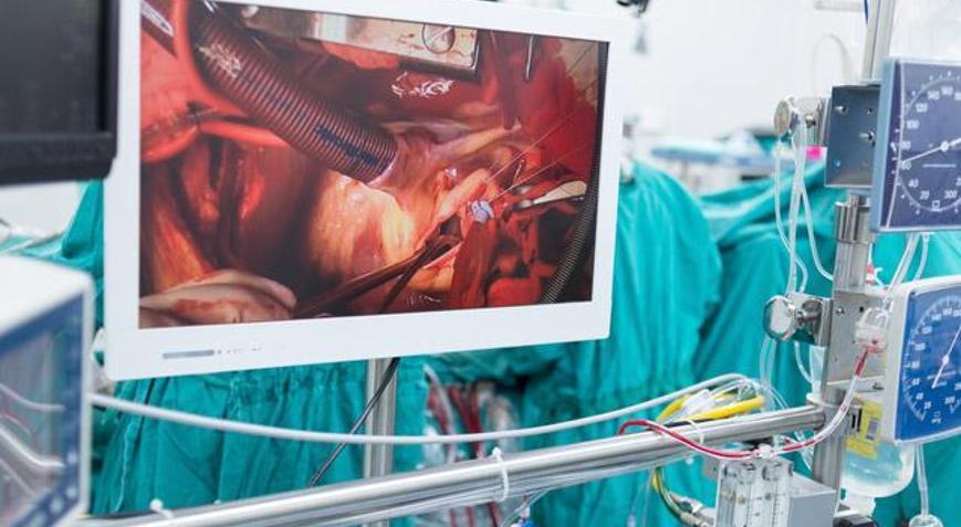 Çalışan kalbe bypass daha az riskli