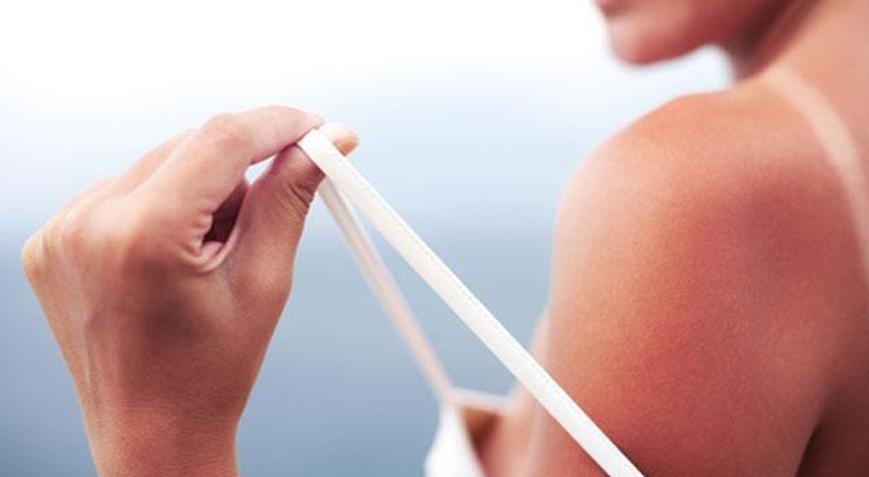 Güneşten korunmak için neler yapmalı