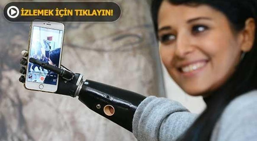 Biyonik kolu yüzünü güldürdü