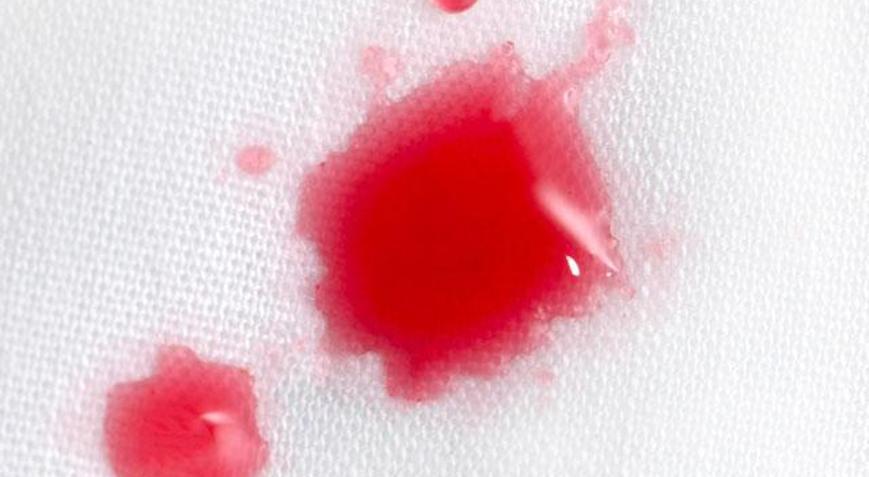 Vişne veya kiraz lekesi nasıl çıkarılır