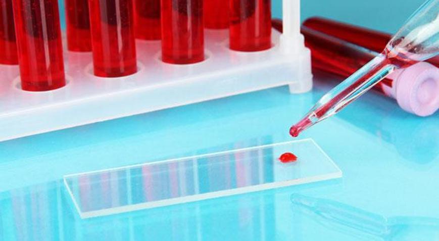 Kan grubuna göre diyet nasıl yapılır