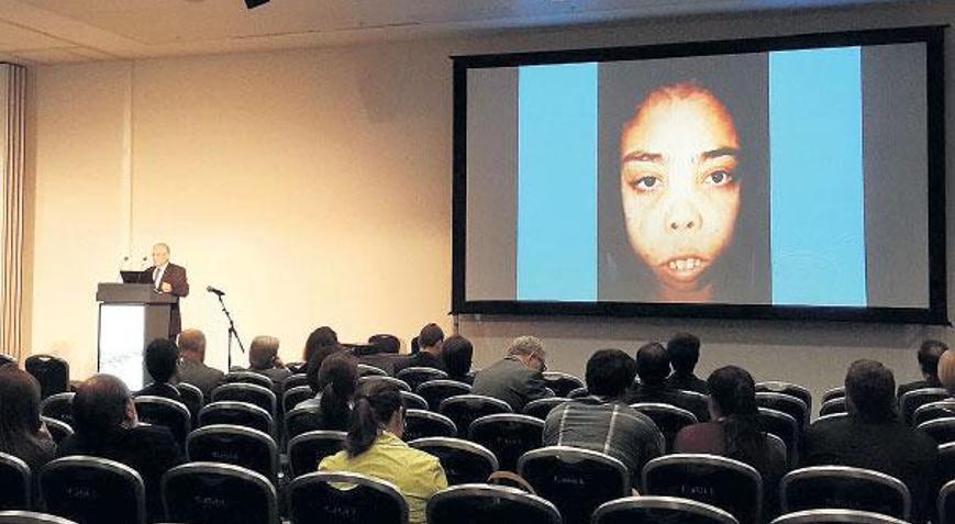 Türk doktor adını verdiği hastalığı Rusya’da anlattı