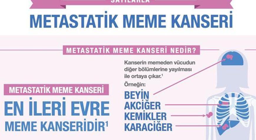 Meme kanserinde kişiye özel tedavi