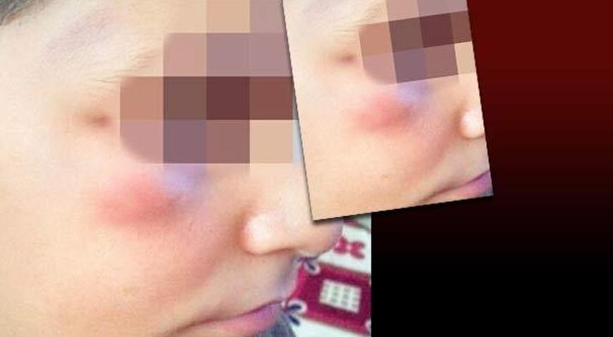 Okul müdürünün empatili dayak savunması