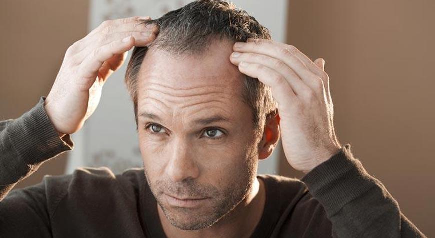 Saç dökülmesine yeni ilaç: İlk denemelerde saç büyümesini %539 oranında artırdı