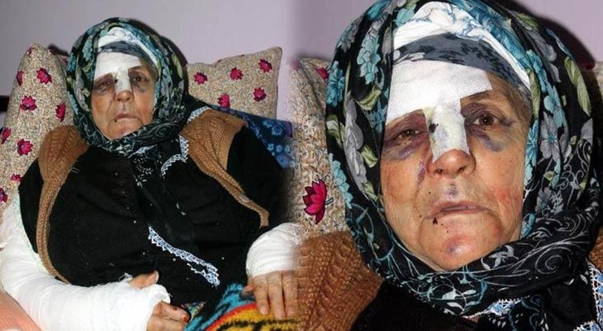 Her satırı dehşet Yaşlı kadını bu hale soktu