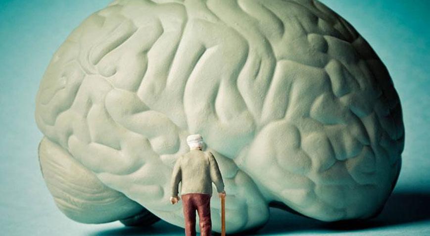 Uzmanı açıkladı: Türkiyede Alzheimer gitgide artıyor