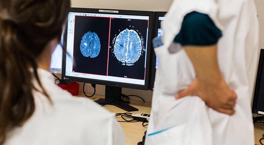 İnme tedavisinde Türk profesörden yüz güldüren yöntem