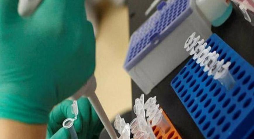 Troponin Nedir Troponin Kaç Olmalı Yüksekliği Ve Düşüklüğü Nedenleri