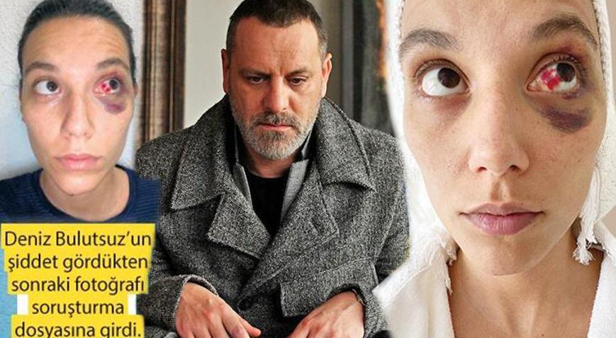 Deniz Bulutsuzun darp edilmiş haline ait fotoğraflar ortaya çıktı