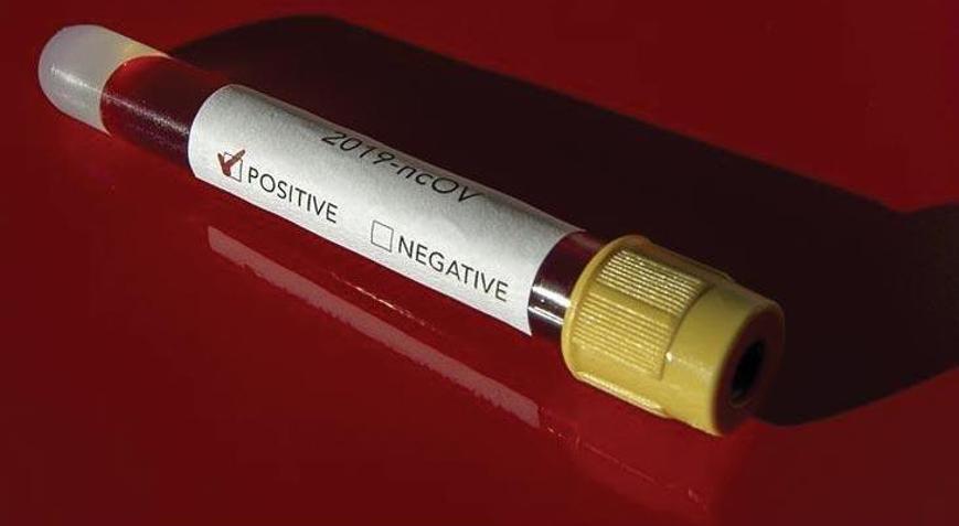 Deprem komisyonunda koronavirüs depremi