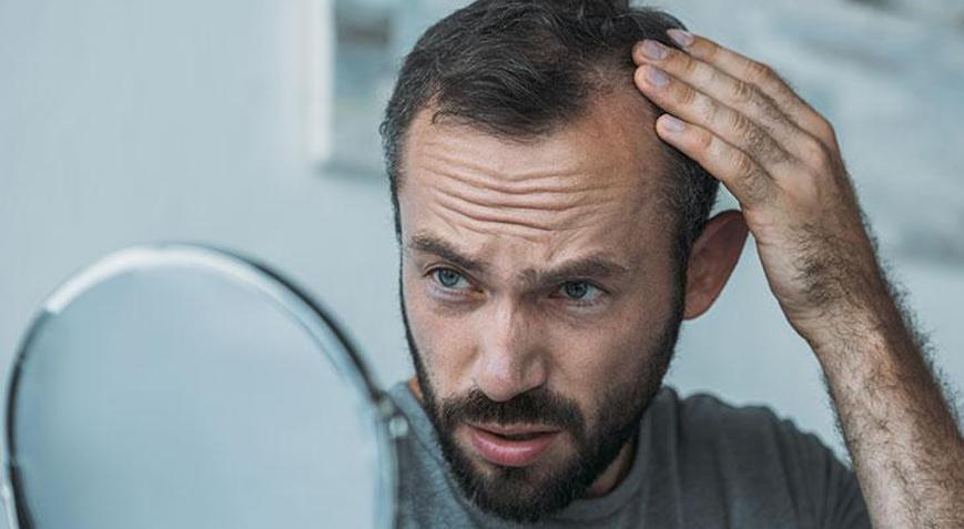 Hasan Akıl: Koronavirüs saç ekimine talep oluşturdu