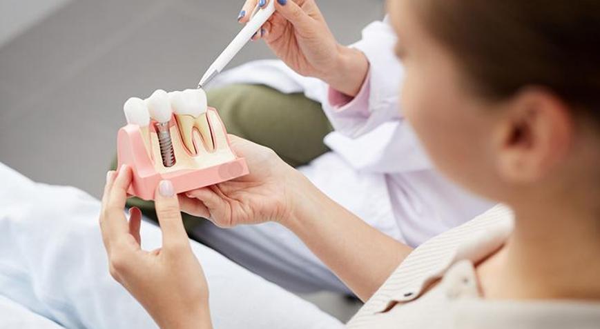 Çene kemiği erimesine alternatif yöntem: Elmacık kemiği (zigoma) implantı