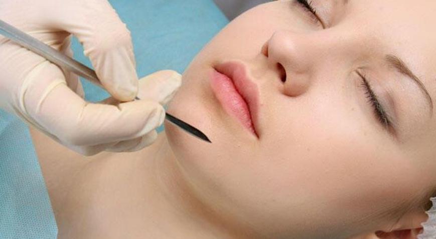 Çene Estetiği Nedir Çene Estetiği Ameliyatı Hangi Sorunlardan Dolayı Tercih Ediliyor