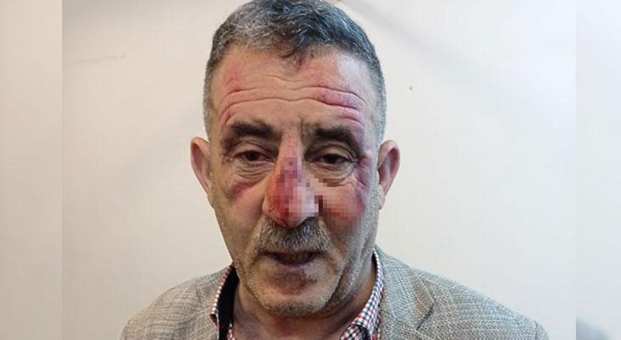 Ağrıda sağlık çalışanı darpedildi
