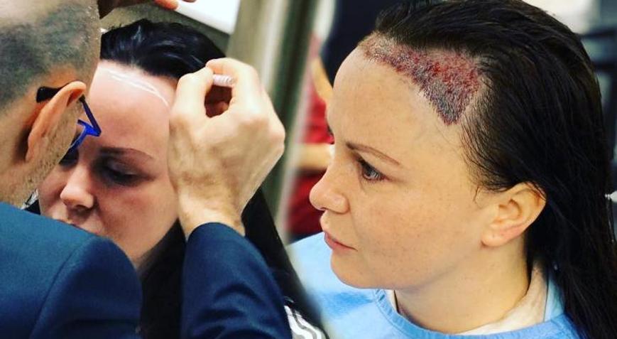 Chanelle Hayes saç ektirdi: Kendimden nefret eder hale gelmiştim