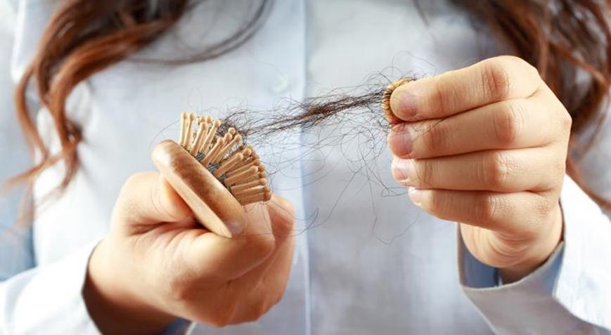 Saç dökülmesini durdurmak için en sık kullanılan yöntemler