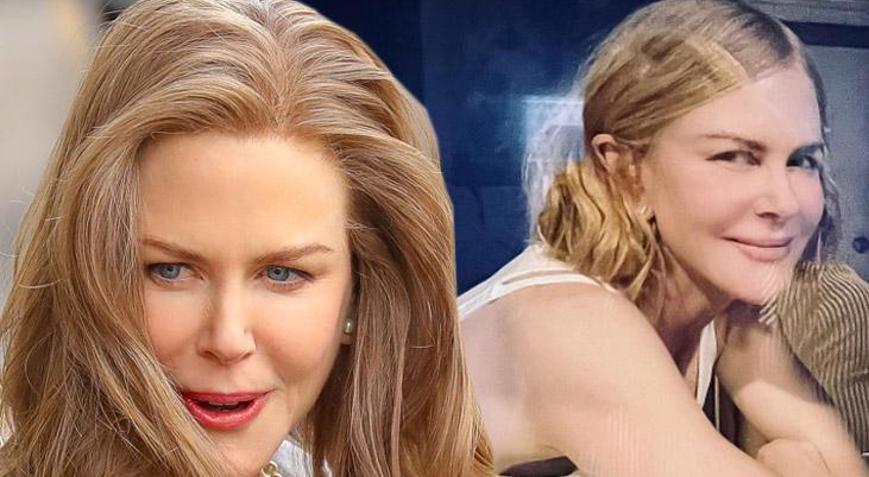 Nicole Kidmanin son hali gündem oldu Lütfen yeter artık