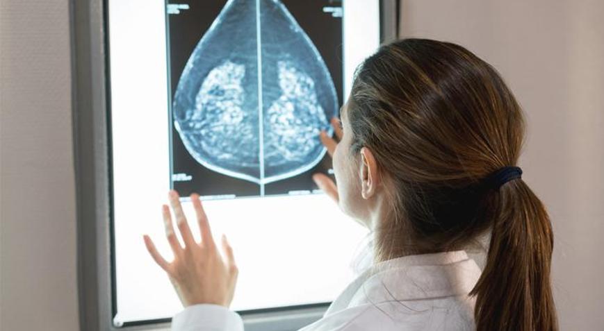 Meme kanserinde beslenme şekli hastalığı yavaşlatıyor