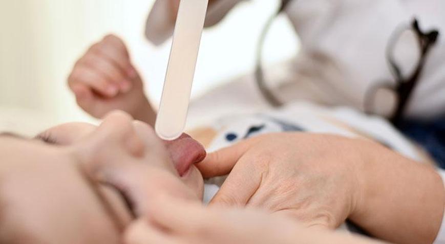 Strep A endişesi: Geç kalınmamalı