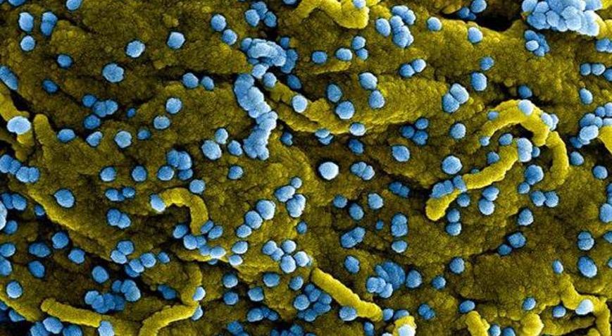 Tedavisi yok Marburg virüsünden ilk ölüm haberleri geldi, sınırlar kapanıyor