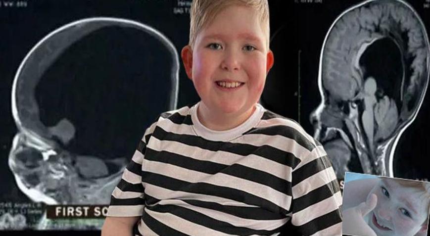 MR baktıklarında adeta beyni yoktu Bir sandviçi tek başına yemesi 2 yılını alsa da başardı